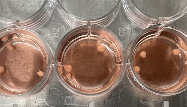 “Mini cerebros” creados en laboratorio ayudan a Mayo Clinic a investigar terapias contra la adicción a los opioides