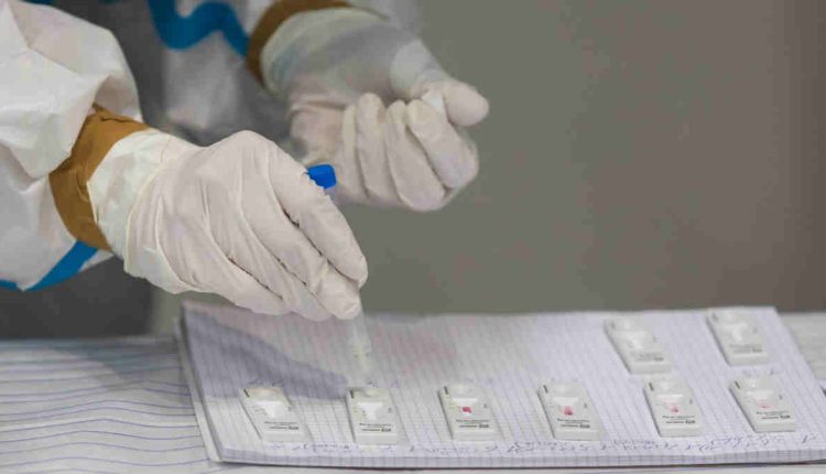 Entre el 80% y 90% de las infecciones virales de la temporada invernal se tratan injustificadamente con antibióticos
