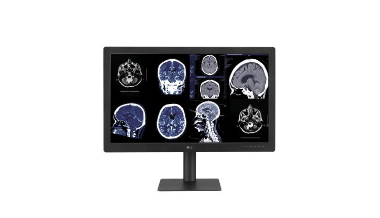 El nuevo Monitor de Diagnóstico LG con IPS Black ofrece una excelente calidad de imagen