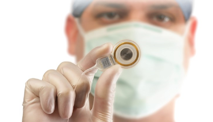 ¿Qué son los implantes cocleares y cómo ayudan a percibir los sonidos del día a día?
