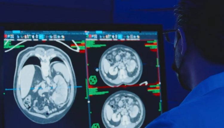 Lanza TecSalud primer centro de tumores cerebrales en México